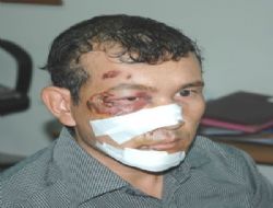 Afgan mülteciye çirkin saldırı